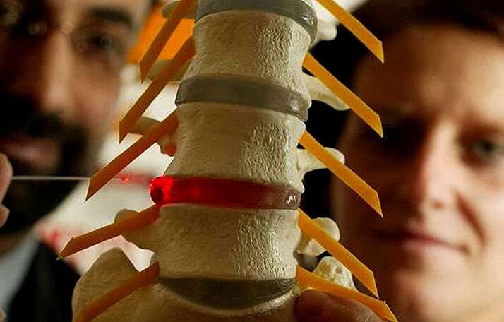 Changes in the integrity of intervertebral discs