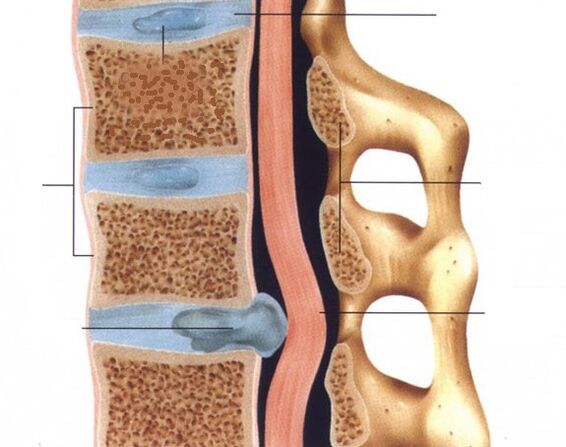 The pronunciation of hernia