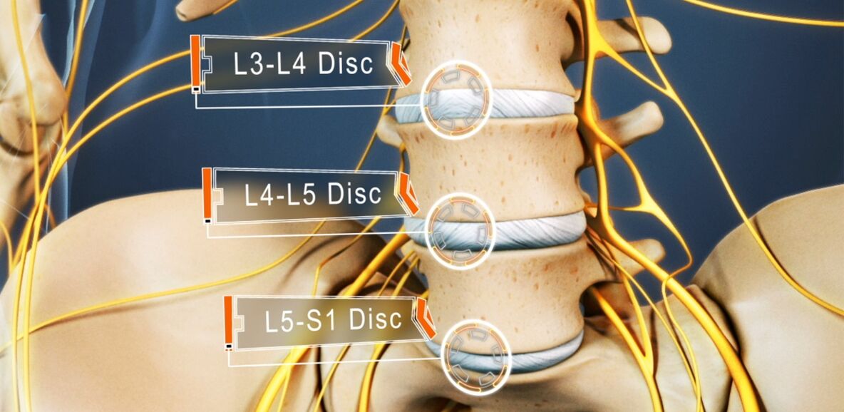 The plates of the lumbar spine that are most commonly involved in osteochondrosis