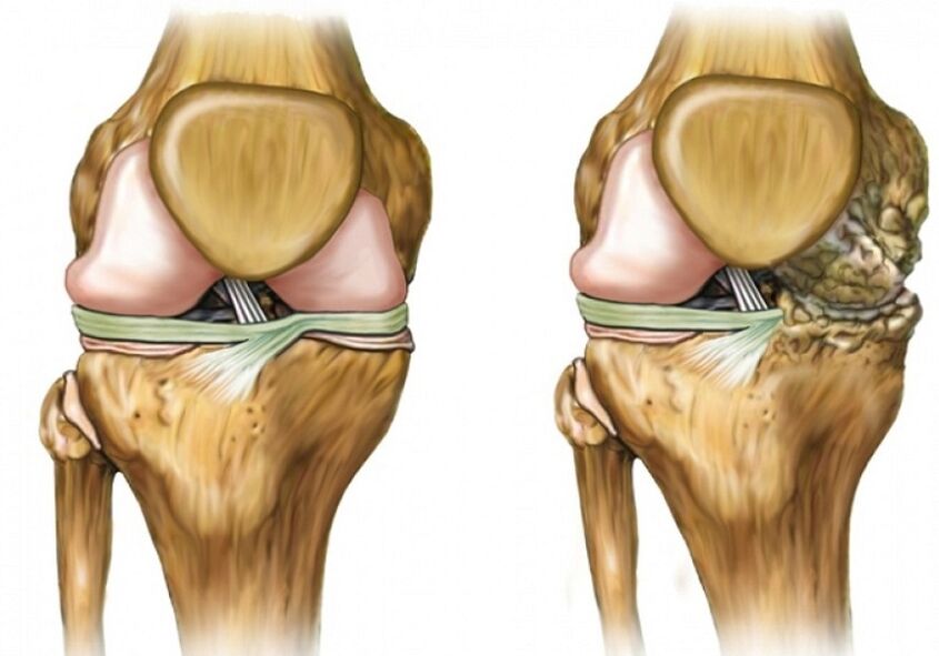 Knee joint