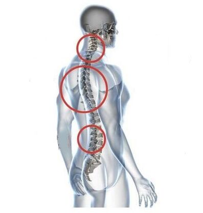 places of osteochondrosis of the spine