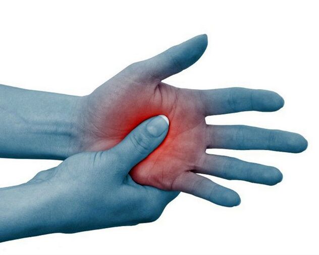 A typical symptom of rheumatoid arthritis is severe pain in the joints of the fingers, which decreases with exercise.